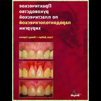 Практическое руководство по пластической пародонтологической хирургии / С. Дибарт