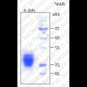 Интерлейкин 6 человека, рекомбинантный белок, rhIL6, Россия, PSG180100, 100 мкг