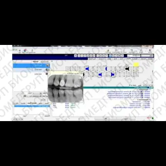 Программное обеспечение для обработки снимков зубов EXAMINE PRO