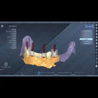 Программное обеспечение для лабораторий DentalCad