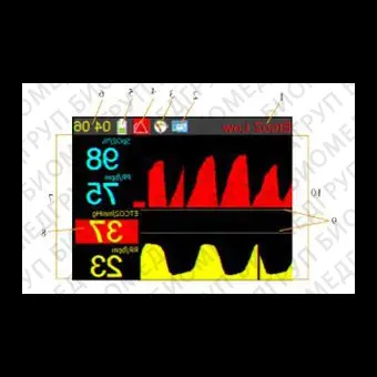 Монитор пациента CO2 Capnoxi