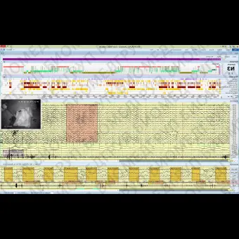 Полисомнограф с EEG