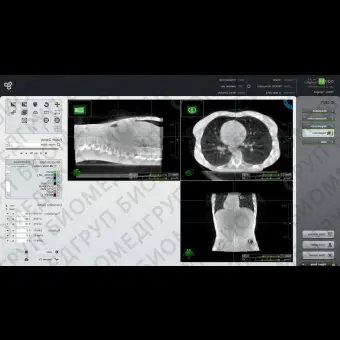Циклотрон для протонной терапии со встроенным рентгеновским сканером Proteus Plus