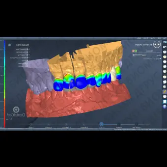 Программное обеспечение для лабораторий DentalCad