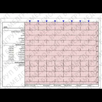 Ветеринарная ЭКГсистема 12 каналов DE12VET