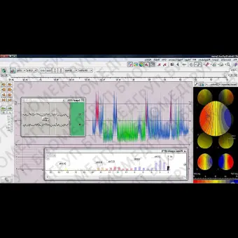 Монитор пациента для ЭЭГ EEGDigiTrack CFM