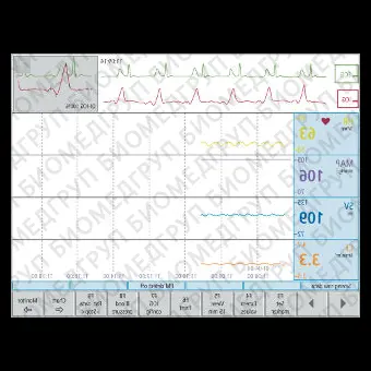 Электрокардиограф для спокойного состояния CardioScreen 2000