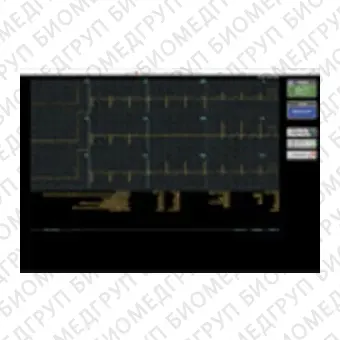 Электрокардиограф для спокойного состояния AMD3350