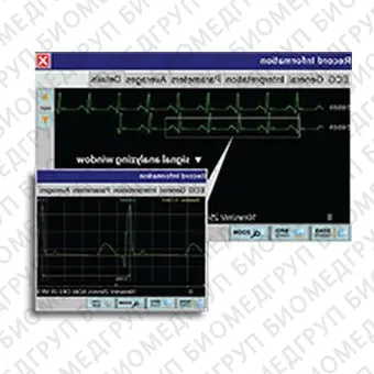 Электрокардиограф для спокойного состояния Cardipia 800 H smart
