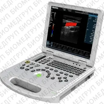 Переносной ультразвуковой сканер DWL50