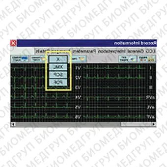 Электрокардиограф для спокойного состояния Cardipia 800 H smart
