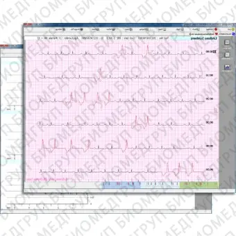 Программное обеспечение для электрокардиографии CVS03