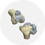 Размер резекции для коленного протеза EMPREINTE
