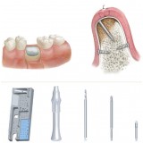 Комплект инструментов для стоматологической хирургии SM01